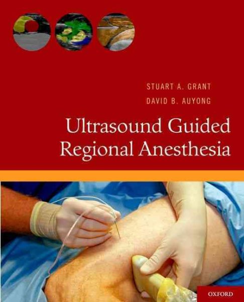Ultrasound Guided Regional Anesthesia cover