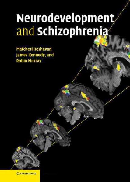 Neurodevelopment and Schizophrenia cover
