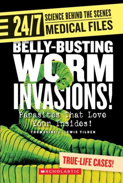 Belly-Busting Worm Invasions!: Parasites That Love Your Insides! (24/7: Science Behind the Scenes)