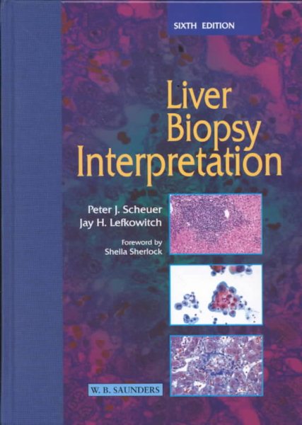 Liver Biopsy Interpretation cover