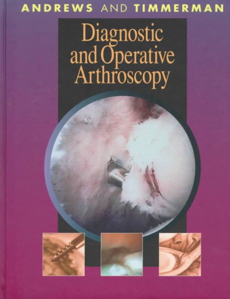 Diagnostic and Operative Arthroscopy, 1e