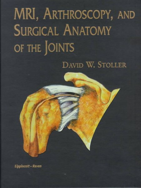 Mri, Arthroscopy, and Surgical Anatomy of the Joints