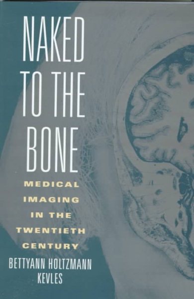 Naked to the Bone: Medical Imaging in the Twentieth Century (Sloan Technology Series)