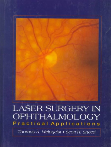 Laser Surgery in Ophthalmology: Practical Applications cover