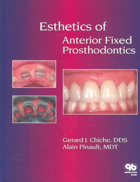 Esthetics of Anterior Fixed Prosthodontics cover