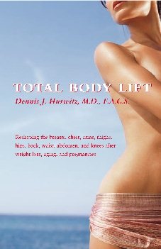 Total Body Lift: Reshaping the breasts, chest, arms, thighs, hips, back, waist, abdomen, and knees after weight loss, (n/a series) cover