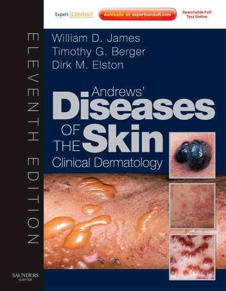 Andrews' Diseases of the Skin: Clinical Dermatology - Expert Consult - Online and Print (James, Andrew's Disease of the Skin)