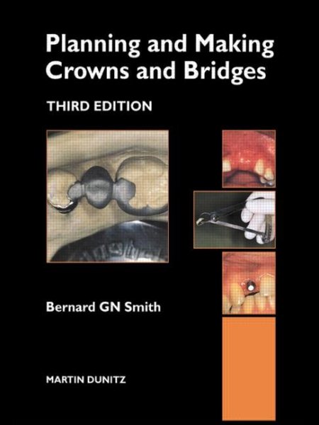 Planning and Making Crowns and Bridges cover