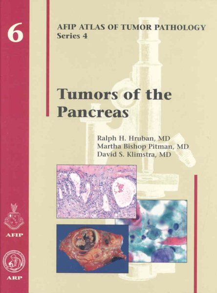 Tumors of the Pancreas (Afip Atlas of Tumor Pathology; 4th Series Fascicle 6) cover