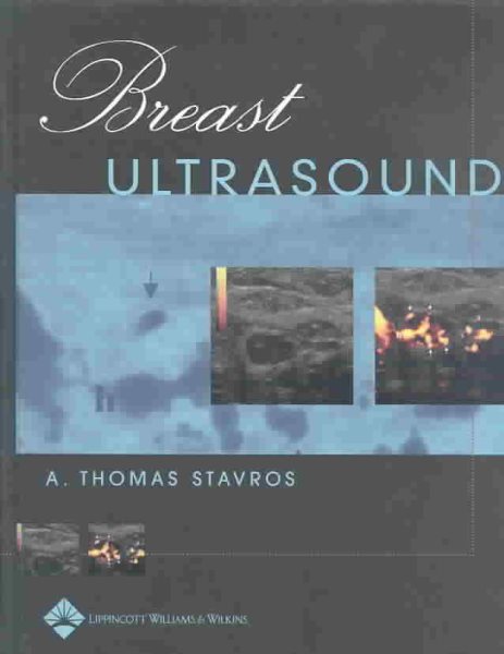 Breast Ultrasound cover