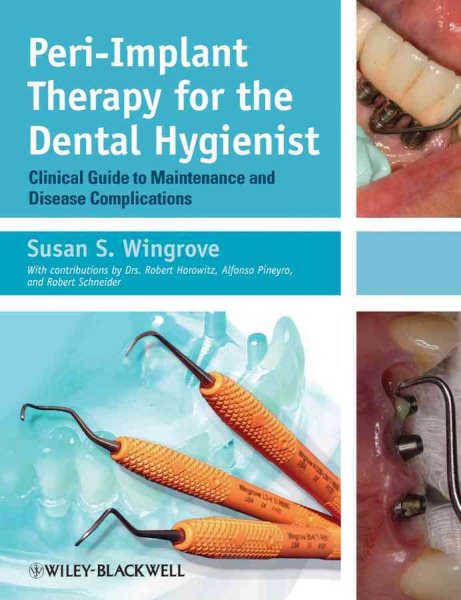 Peri-Implant Therapy for the Dental Hygienist: Clinical Guide to Maintenance and Disease Complications cover