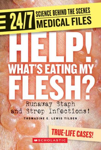 Help! What's Eating My Flesh?: Runaway Staph and Strep Infections! (24/7: Science Behind the Scenes: Medical Files) cover