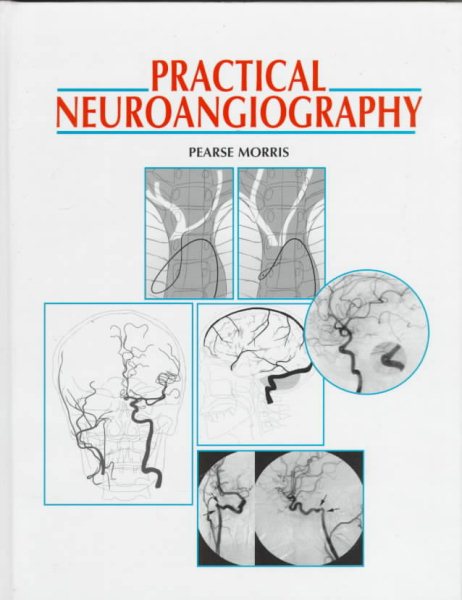 Practical Neuroangiography cover