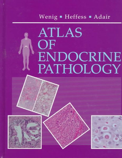 Atlas of Endocrine Pathology: A Volume in the Atlases in Diagnostic Surgical Pathology Series