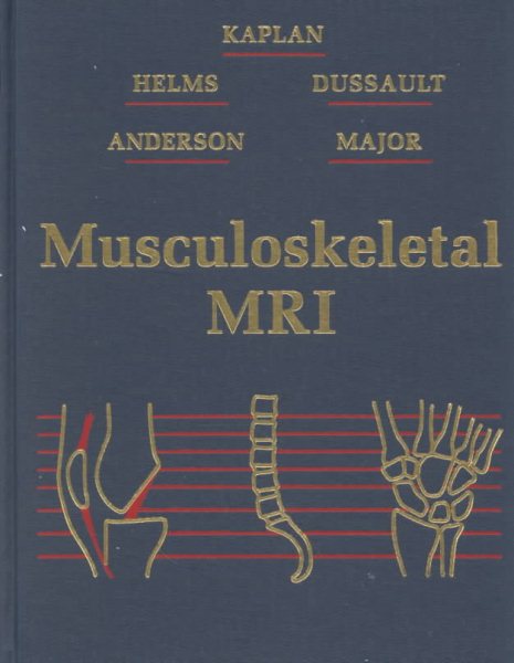 Musculoskeletal Mri cover