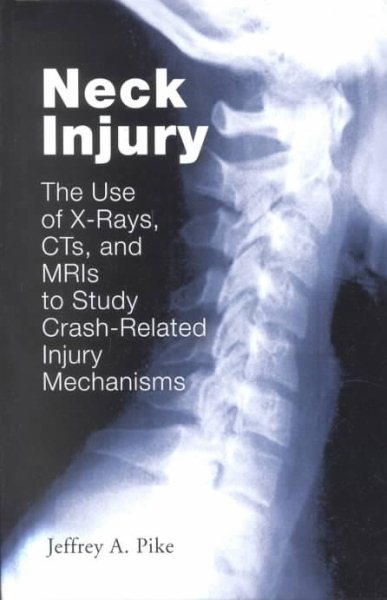 Neck Injury: The Use of X-Rays, CT's, and MRI's to Study Crash-Related Injury Mechanisms [R-268] cover