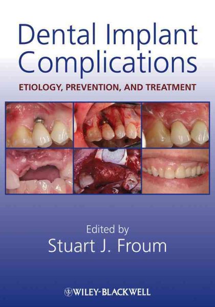 Dental Implant Complications: Etiology, Prevention, and Treatment cover