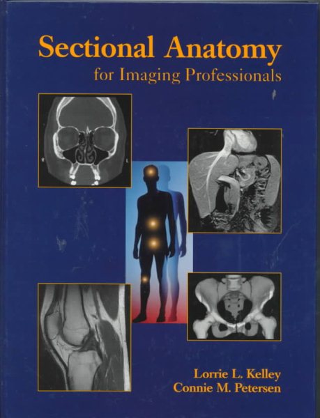 Sectional Anatomy for Imaging Professionals cover