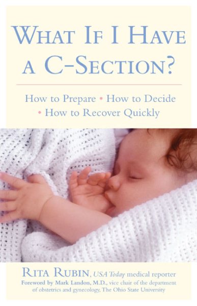 What If I Have a C-Section? cover