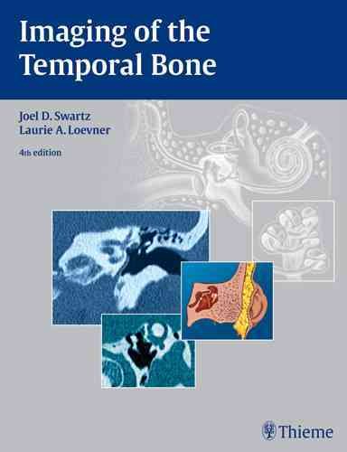 Imaging of the Temporal Bone cover