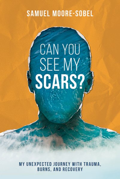 Can You See My Scars? cover