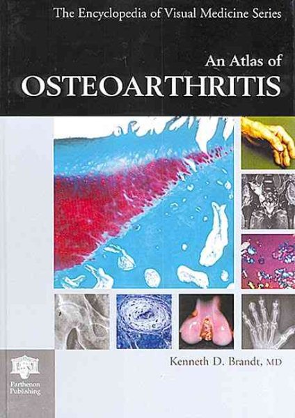 An Atlas of Osteoarthritis cover