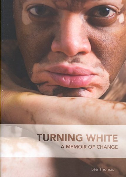 Turning White: A Memoir of Change cover