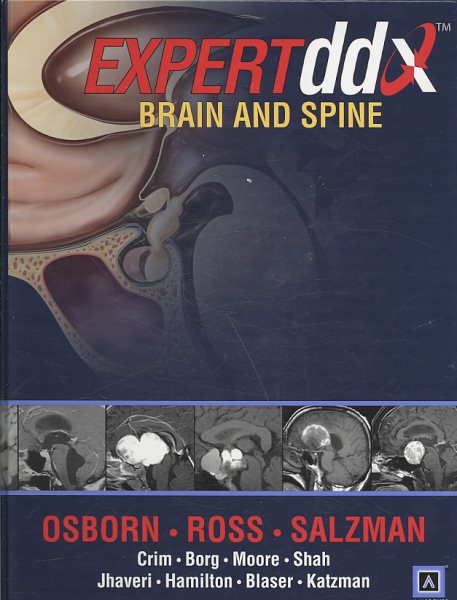 Expertddx: Brain and Spine cover
