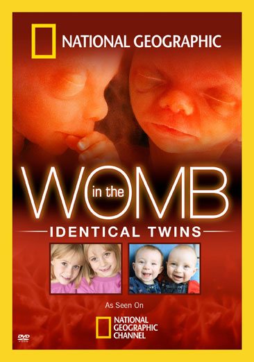 In the Womb: Identical Twins cover